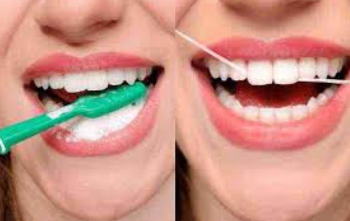 Dental Hygiene After Sealants