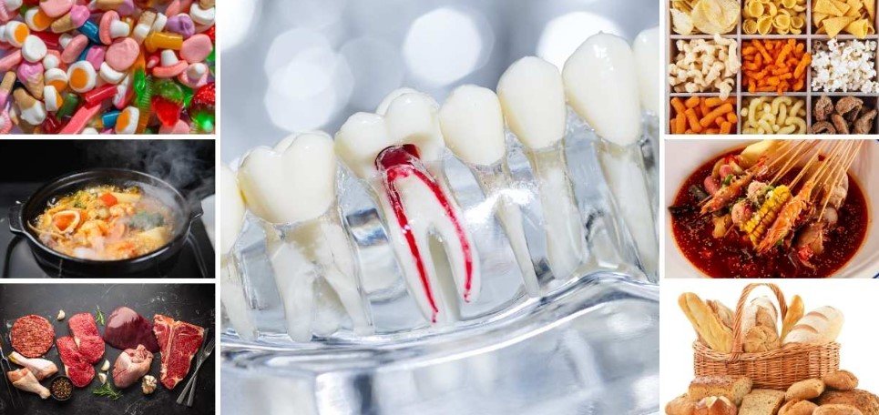 Foods to eat and foods to avoid after root canal