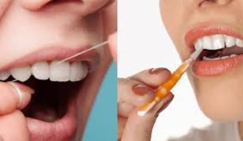 Oral hygiene after root canal