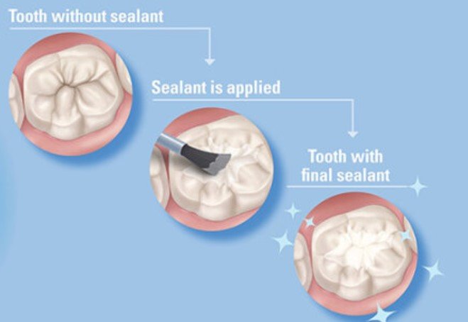 Recovery and Outlook