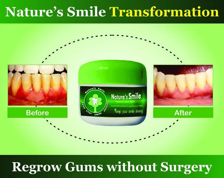 Natures Smile Transmission